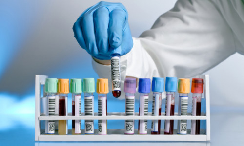 lad working holding up blood specimin vial